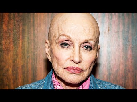 Dolly Parton Can No Longer Hide Her Secret