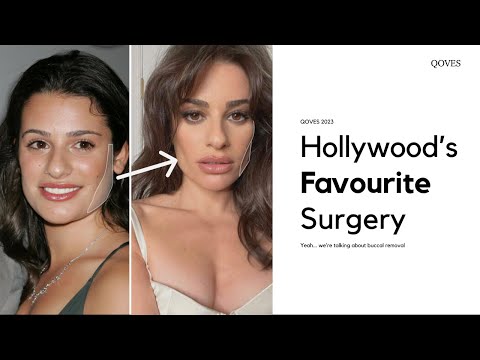 Buccal Fat Removal: easy shortcut to the model-look?