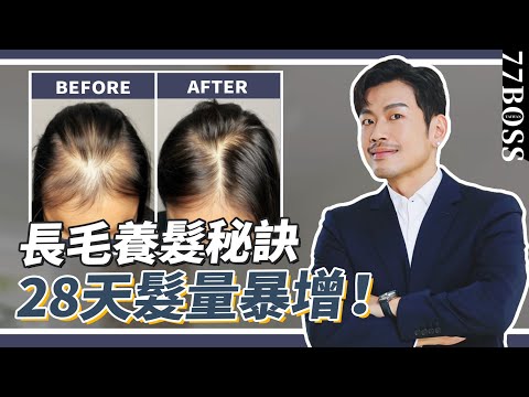 28天養髮攻略！學會這秘訣，髮量激增，髮縫寬、壓力落髮、雄性禿必學，越早效果越好！【77老大】