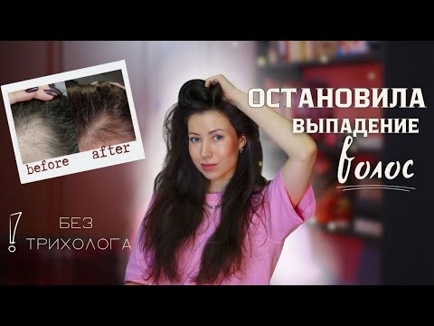 Я почти потеряла волосы, но остановила выпадение благодаря этим средствам