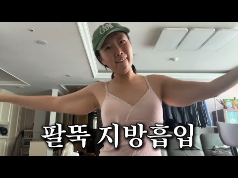 A super realistic vlog of me gaining 4kg after liposuction