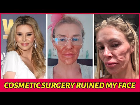 25 Plastic Surgery Disasters You Won’t Believe Happened