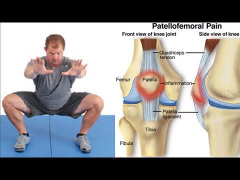 Becoming a Brittle Leopard : Do Kelly Starrett's Teachings Cause Injury?