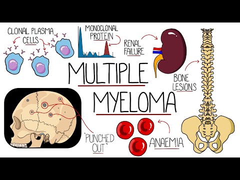 Understanding Multiple Myeloma (Multiple Myeloma Explained Clearly)