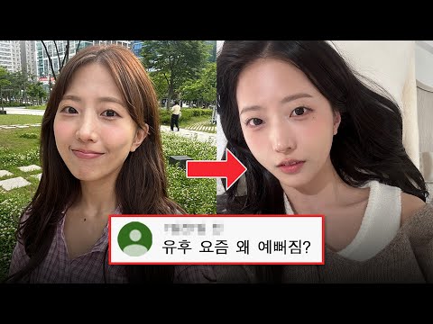 성형? 시술? 최근 6개월간의 변화과정 모두 알려드림