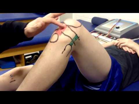 Knee - Surface Anatomy, ROM & Strength