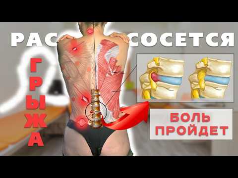 Как ГРЫЖА исчезнет. БОЛЬ в спине и шее пройдет, ЕСЛИ… l ПОЛНОЕ РУКОВОДСТВО