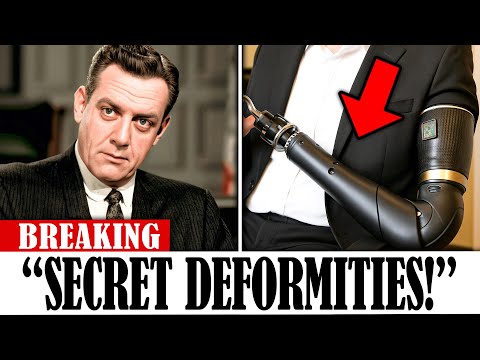 7 Golden Age Stars Born With SECRET Deformities