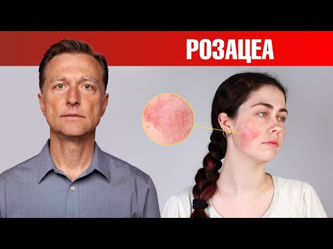 Если у вас розацеа, то ЭТО поможет. 🙌