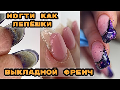 НОГТИ ЛЕПЕХИ 😅 Выкладной френч на ногтях 💅 Френч пошагово 💅 Как поднять клюющий ноготь