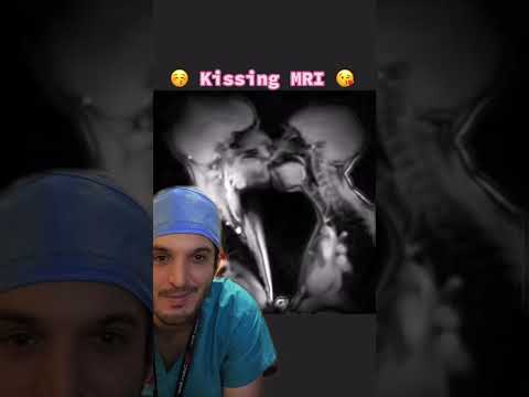Tag someone you want to 💋 #kissme #sixpencenonethericher #kiss #kissing #mri #radiology