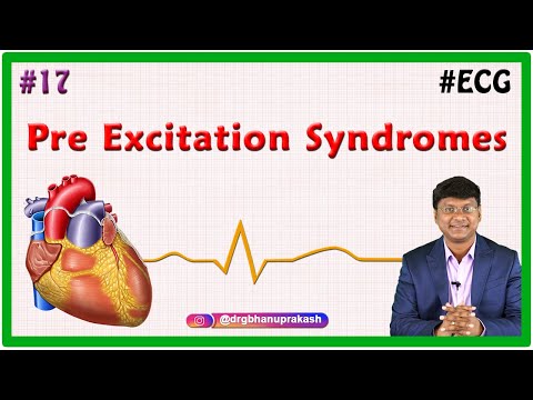 17. Pre Excitation Syndromes ( Lown-Ganong-Levine syndrome & Wolff-Parkinson-White (WPW) pattern )