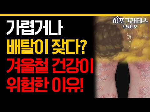 (40분) 특히 환절기, 가려움증 알레르기 있다면 필수 시청👆 골든 타임에 면역 질환 예방하기!