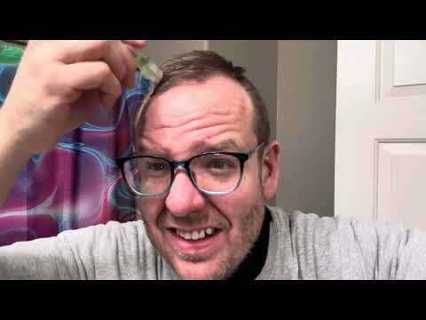 From Bald to Bold: Using Alphainfuse for a month - SCAM or LEGIT