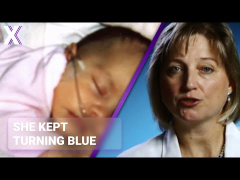 Baby Turns Blue Doctors Cant Explain Why
