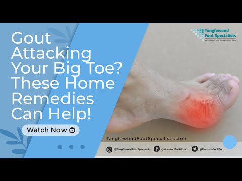 Gout Attacking Your Big Toe? These Home Remedies Can Help!