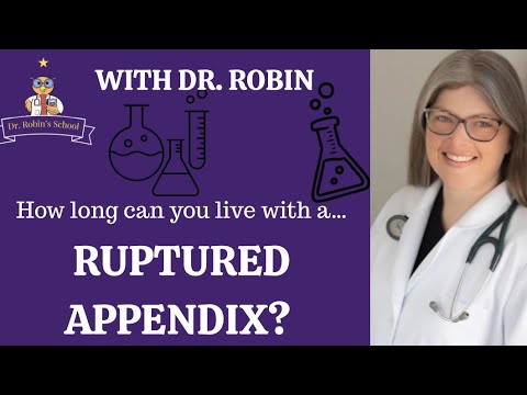 How long can you live with a RUPTURED APPENDIX?