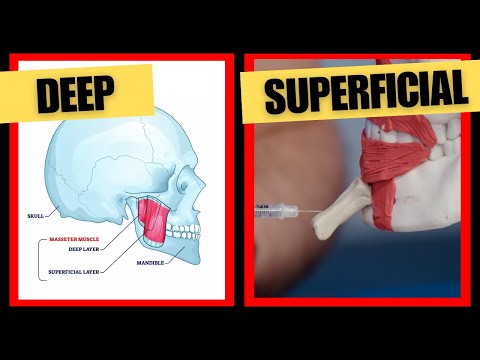 The Best Lower Face Botox Injection Depths  | Botox Injection Depth Guide