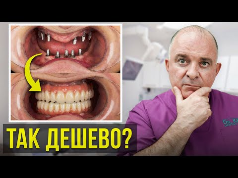 Имплантация при полной потере зубов! Самый бюджетный способ