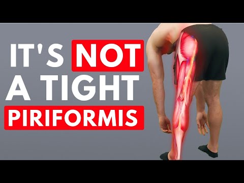 Sciatica Isn’t What You Think – Here’s the REAL Fix