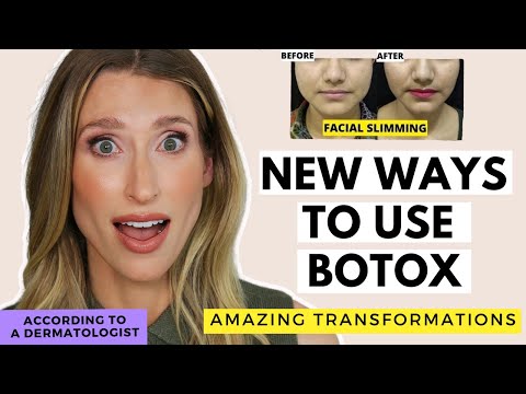 Surprising New Ways to Use Botox | Dermatologist Explains