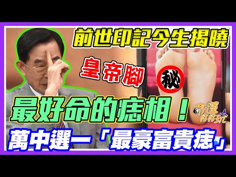 前世胎記富貴痣！黃友輔揭曉萬中選一的好命人！天生皇帝腳的痣相長怎樣？｜每周精選
