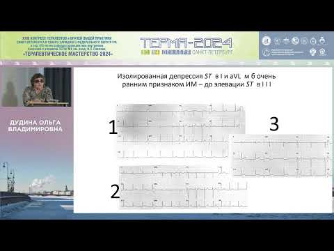 Этот многоликий сегмент ST (экскурс в тайны ЭКГ-диагностики ИБС)