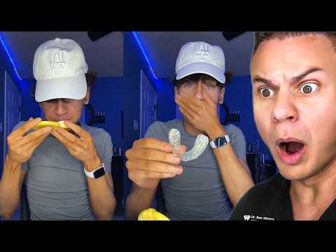 He Hasn't Worn His Retainer In 7 MONTHS