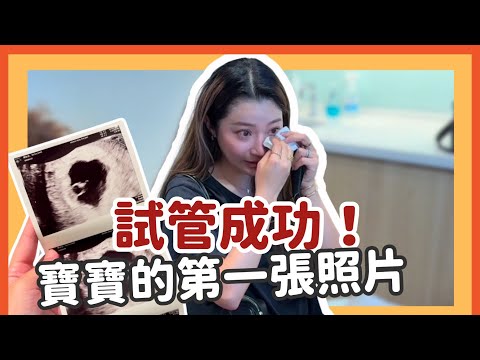 IVF successful! Baby's first photo | Chen Yiyi