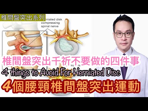 椎間盤突出千祈不要做的四件事(上集)腰頸椎間盤突出運動 [Eng Subtitles] 4 Things to Avoid for Herniated Disc (Part 1)