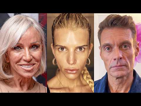 Hollywood Has a New 'Ozempic Face'… And It's TERRIFYING