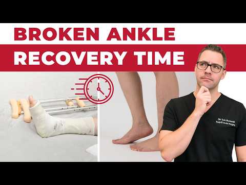 Broken Ankle Recovery Time [Ankle & Fibula Fracture Tips]