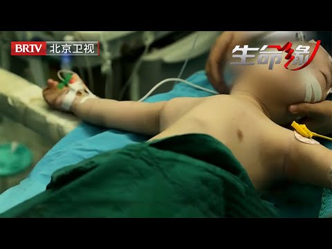 3岁男童胸廓畸形，呼吸濒临衰竭！父母跪求医生，基因悲剧令人揪心【生命缘第12季】
