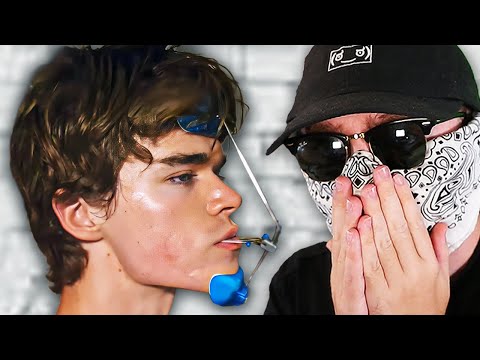 "Looksmaxxing" is Getting Ridiculous