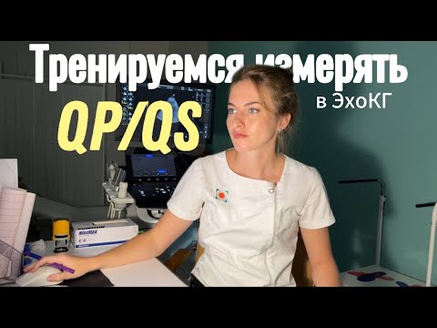 How to measure Qp/Qs in echocardiography? A simple explanation