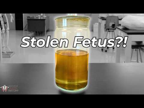 We Almost Got Robbed... Of a Fetus.