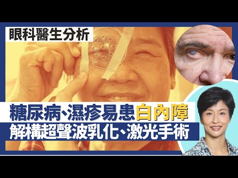 白內障｜糖尿病、濕疹病人易患白內障？眼科醫生解構超聲波乳化手術、激光白內障手術 手術無需等熟透？怕光、近視遠視急速加深都是白內障先兆｜王建芳醫生 眼科醫生袁尚清醫生｜人類健康研究所