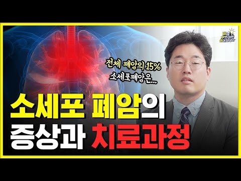 전이가 잘 되는 소세포 폐암 치료 총정리 l  안 좋은 예후때문에 미리 겁먹지 마세요!