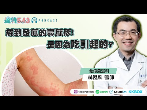 癢到發瘋的蕁麻疹！一到下午就開始癢？是因為吃引起的？ft. 林泓科醫師【達特543 Podcast】EP.14