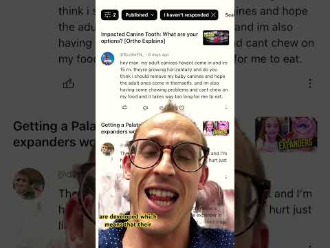 Impacted canines! @ScytheFN_ #dentist #teeth #braces