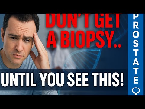 The PSE Test: A Smarter Way to Detect Prostate Cancer (Beyond PSA)