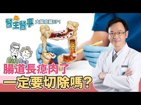 大腸癌症狀 發生原因？ 腸道瘜肉一定要切除嗎？【 醫生醫事 大腸癌篇EP1】 梁程超醫師