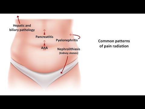 An Approach to Acute Abdominal Pain