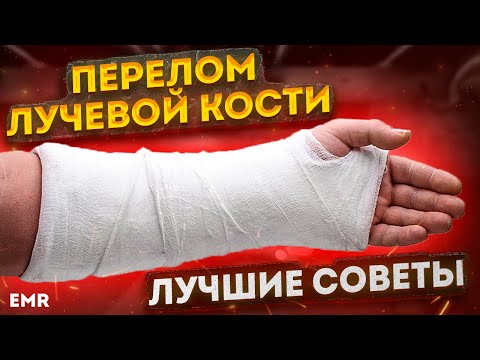 Перелом лучевой кости. ЛФК и ЛУЧШИЕ СОВЕТЫ для восстановления