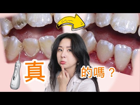 [你誤解 沖牙機了]  真的需要買嗎？牙醫示範如何正確使用！