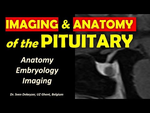 Anatomy and Imaging of the Pituitary Gland