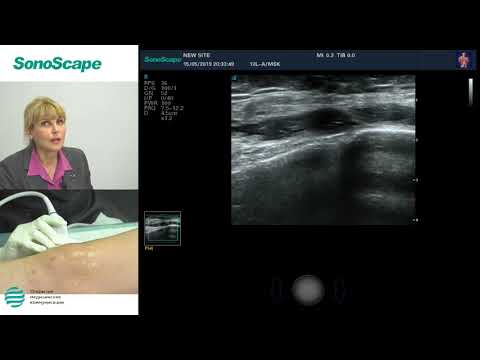 Мастер-класс на аппарате SonoScape S40Exp. Лектор: Салтыкова В.Г.