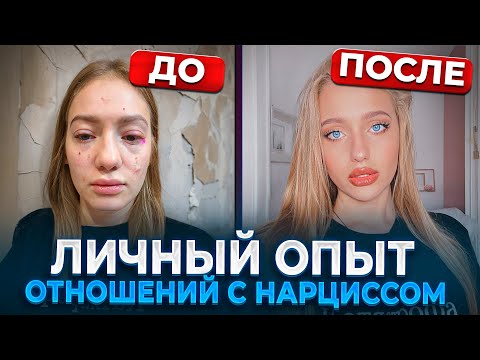 АБЬЮЗЕР. ЛИЧНЫЙ ОПЫТ. Физическое и эмоциональное насилие. Нарцисс, абьюз