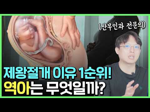 아이 머리가 위에 있는 "역아", 이러면 정말 큰일입니다!