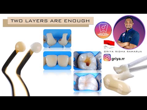 COMPOSITE WEBINAR "TWO LAYERS ARE ENOUGH" BY DR GRIYA RIDHA RAHARJA INDONESIA